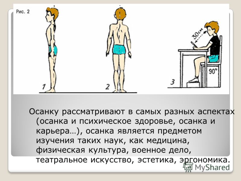 Осанка 8 класс. Задачи правильной осанки. Как сохранить осанку. Правила красивой осанки. Правила ровной осанки.