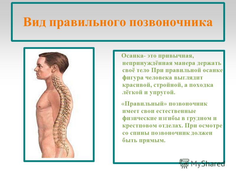 Правильный позвоночник. Осанка позвоночник. Правильная осанка спины. Позвоночник при правильной осанке. Позвоночник человека с правильной осанкой.