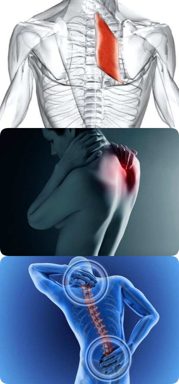 Болят мышцы спины причины. Боль в спине. Болит спина. Болит лопатка.