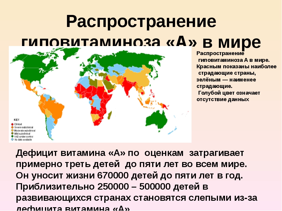 Дефицит д3. Карта дефицита витамина д. Распространенность дефицита витамина д в мире. Дефицит витамина д в России.