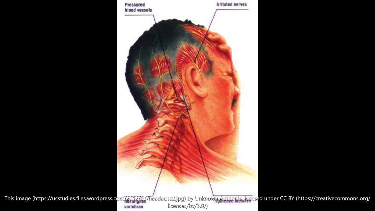В области затылка и шеи. Болит затылок. Болит шея и затылок справа. Боль в шее и затылке слева.