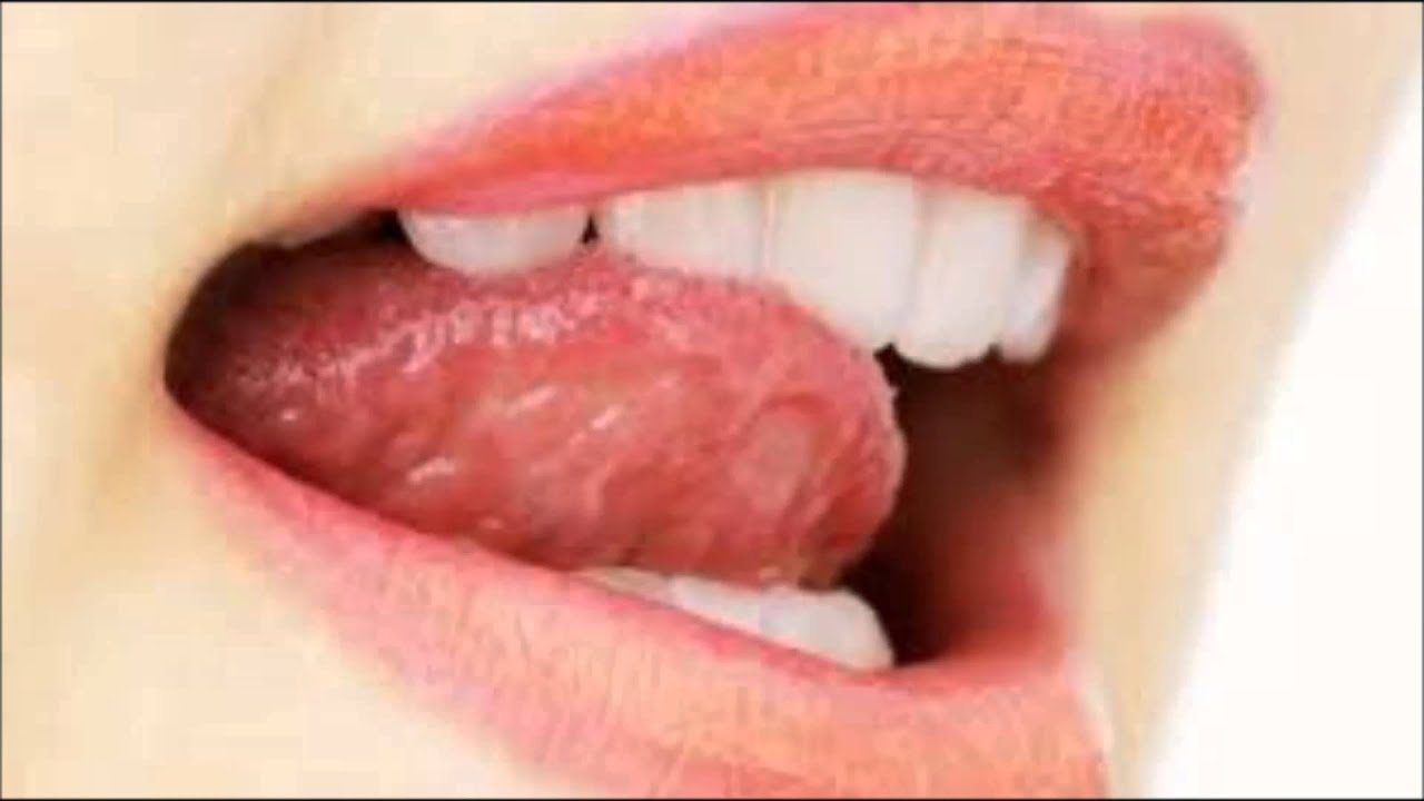 Постоянная слюна во рту. Зеленый язык и кислота во рту причины.