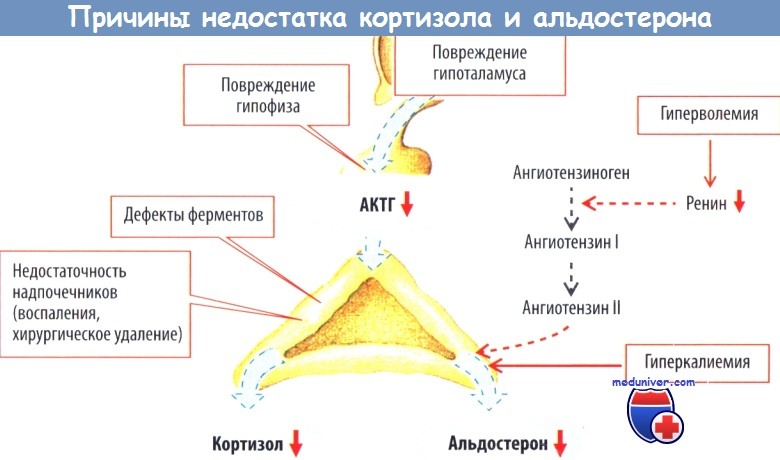 Признаки повышенного кортизола у женщин