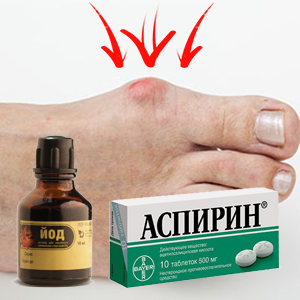 Лечим шишку народными средствами