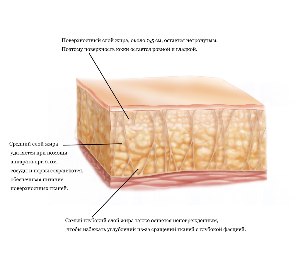 Слои жира. Подкожный слой жира. Подкожной жировой слой на живота.
