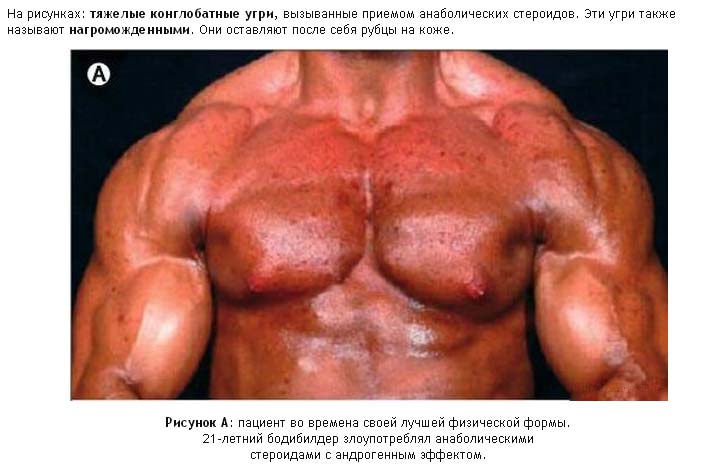 Побочные эффекты от метана в фотографиях