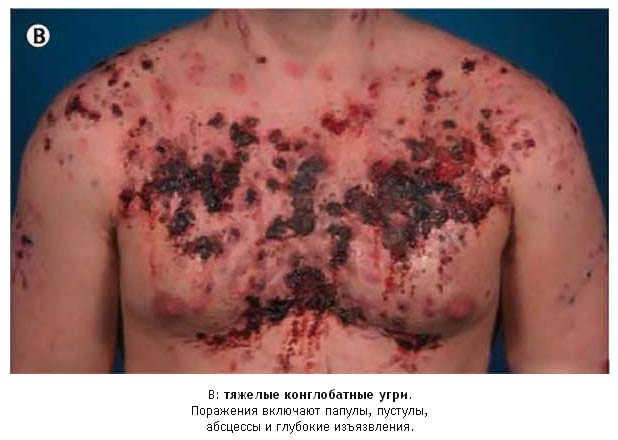Побочные эффекты от метана в фотографиях