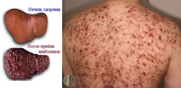 Побочные эффекты от метана в фотографиях