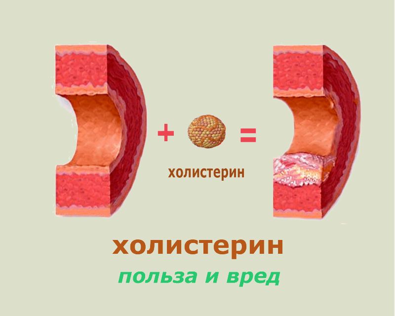 Полезный холестерин